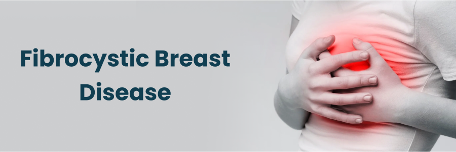 Fibrocystic Breast Disease