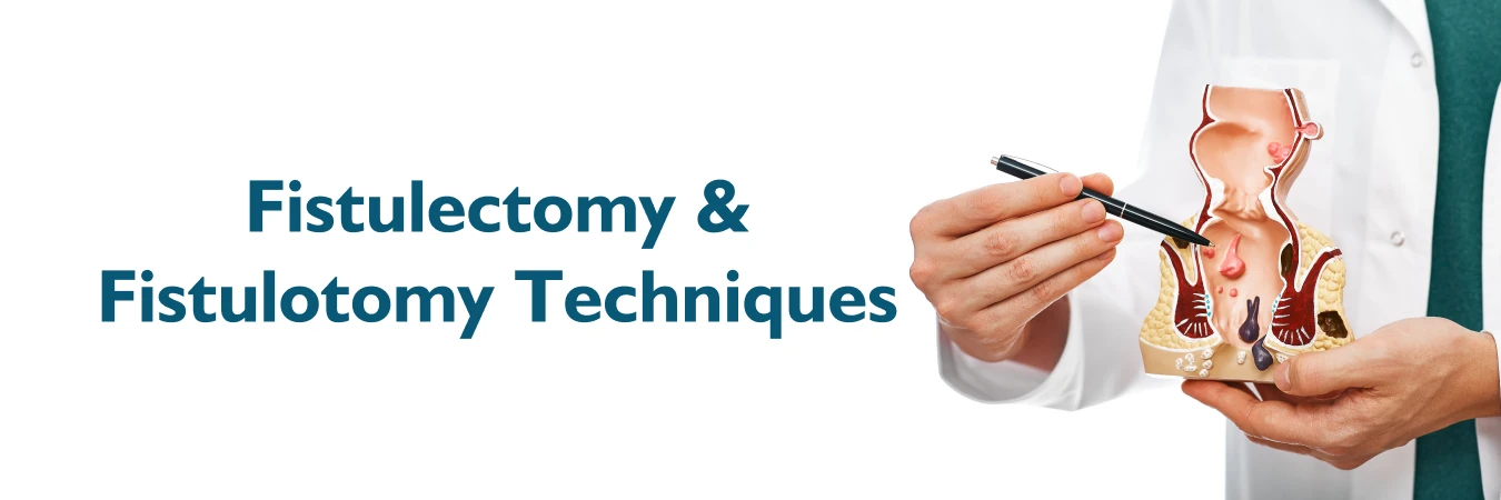 Fistulectomy VS Fistulotomy