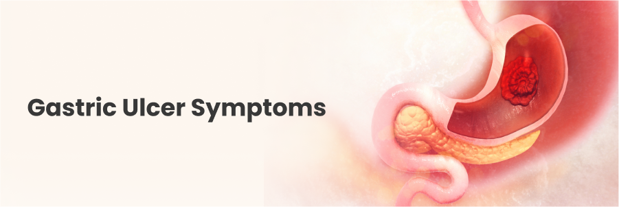 Gastric Ulcer Symptoms