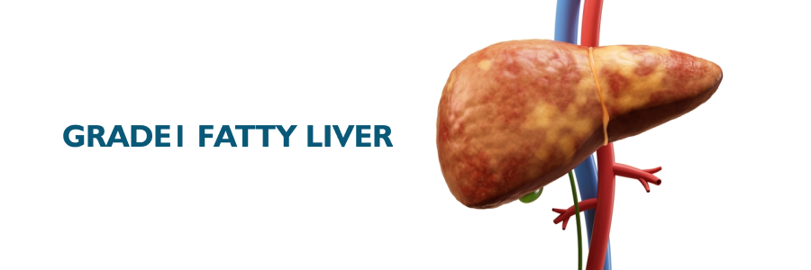 Grade 1 fatty liver