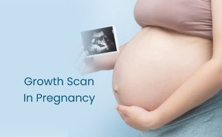 Pregnancy Growth Scan