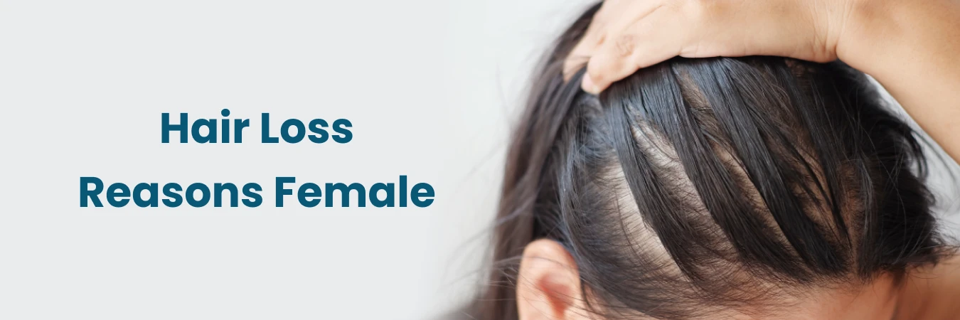 Hair Loss Reasons Female