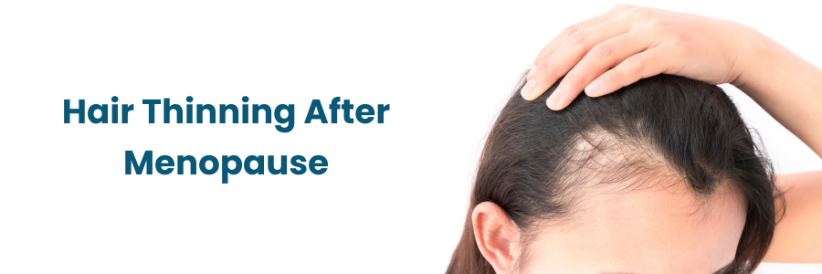 Hair Thinning After Menopause