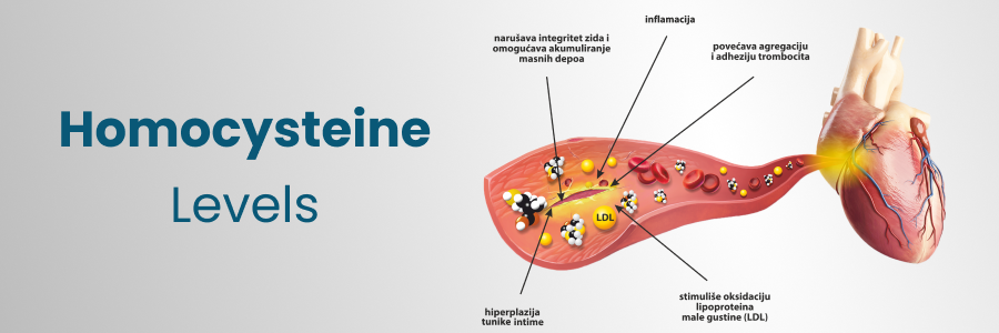 Homocysteine Levels