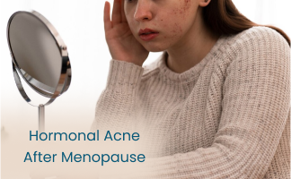 Hormonal Acne After Menopause: Causes and Treatments