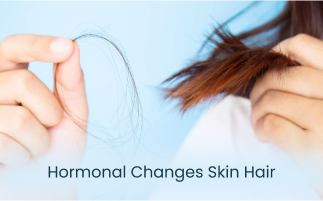 How Hormonal Changes Affect Your Skin and Hair