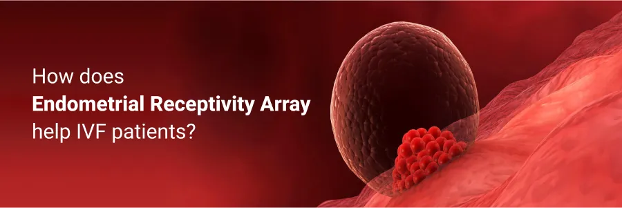 How Does Endometrial Receptivity Array Help Ivf Patients