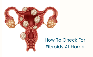 Fibroid Detection at Home Symptoms to Monitor and SelfCheck