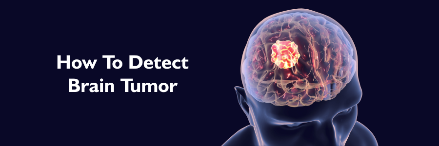 Brain Tumors: Signs and Symptoms
