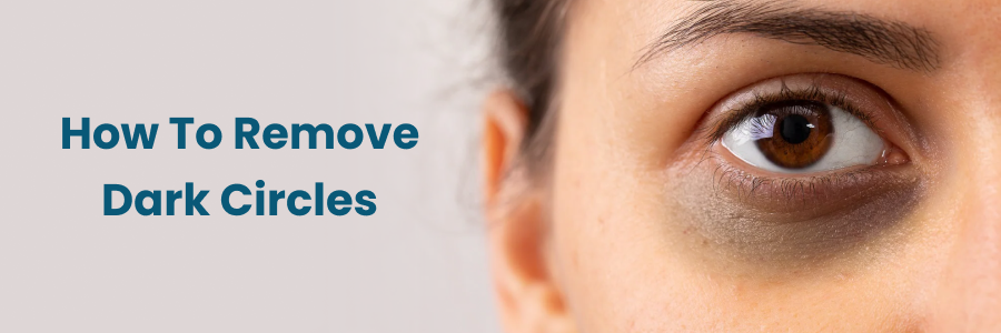 How To Remove Dark Circles