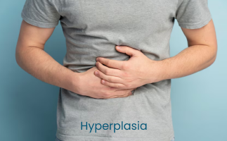 Hyperplasia: Causes, Types, Symptoms, Diagnosis, & Treatment