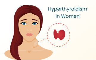 Hyperthyroidism in Women Symptoms Diagnosis Treatment