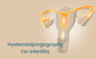 Hysterosalpingography for Infertility Diagnosis