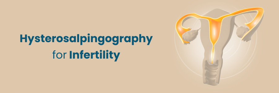 Hysterosalpingography For Infertility