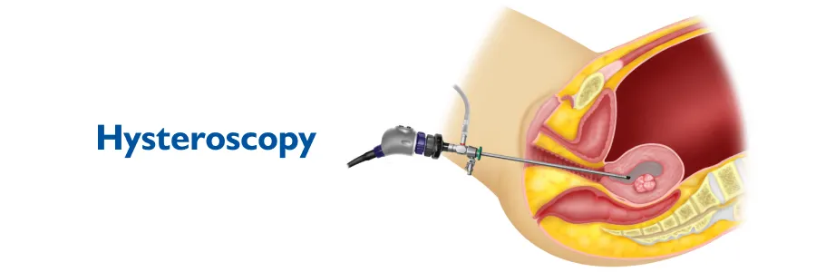 Hysteroscopy