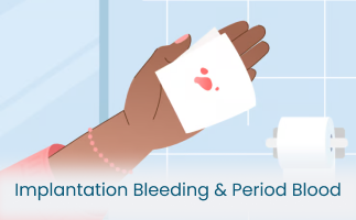 Distinguishing Implantation Bleeding from Period Blood 