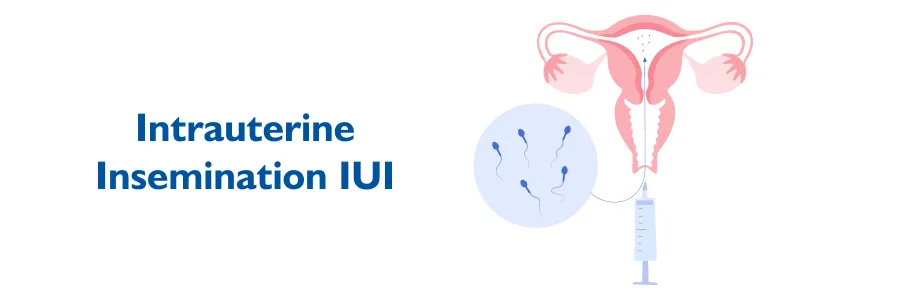 Intrauterine Insemination