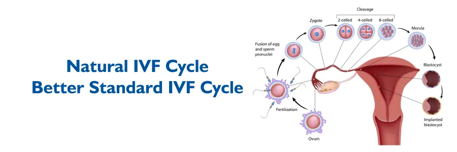 Natural IVF Cycle Better Standard IVF Cycle