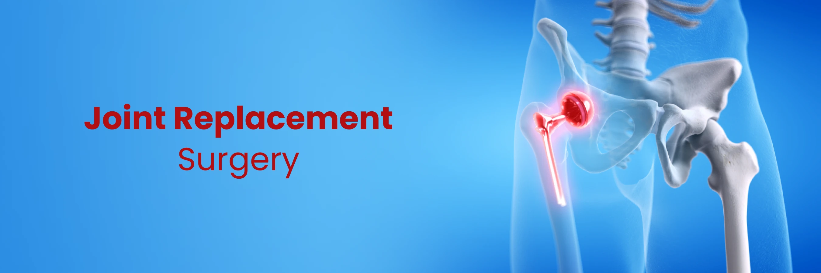 joint replacement surgery
