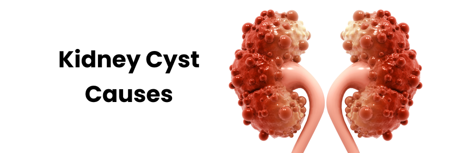 Kidney Cyst Causes