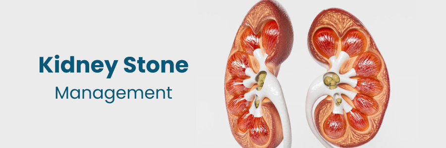 Kidney Stone Management in Begumpet