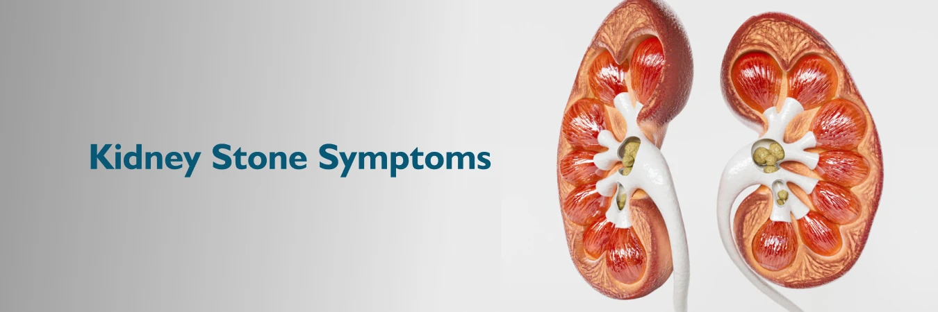 Kidney Stone Symptoms in Women