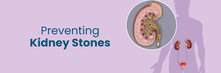 Preventing Kidney Stones Tips and Strategies
