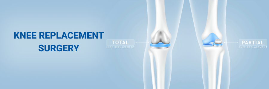 Knee Replacement