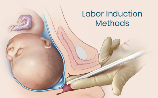 What are the procedures involved in labor induction