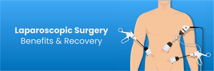 Laparoscopic Surgery: Benefits and Recovery in Bengaluru