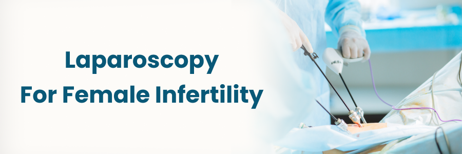 Laparoscopy for Female Infertility