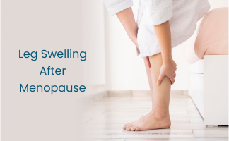 Leg Swelling After Menopause: Causes and Management