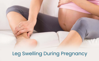 Leg Swelling During Pregnancy Causes and Management