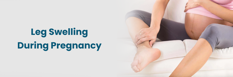 Leg Swelling During Pregnancy