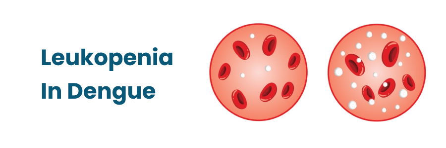 Leukopenia in Dengue Fever