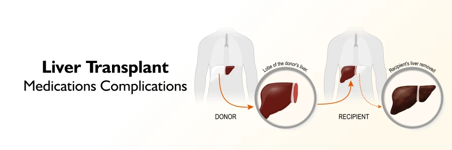 Liver Transplant Medications Complications