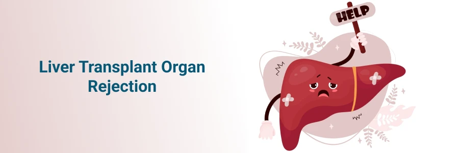 Liver Transplant Organ Rejection Symptoms & Treatment