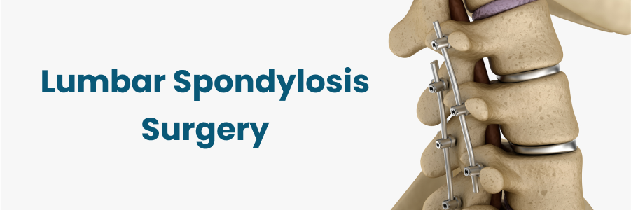 Lumbar Spondylosis Surgery