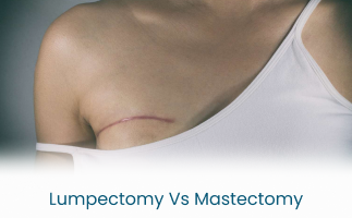 Lumpectomy vs Mastectomy Procedure Comparison