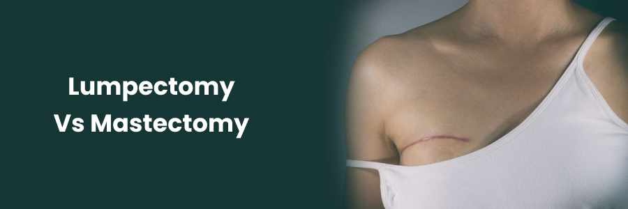 Lumpectomy vs. Mastectomy