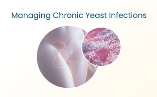 Chronic Yeast Infections Symptoms Causes and Prevention Tips