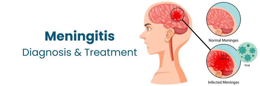 meningitis diagnosis and treatment