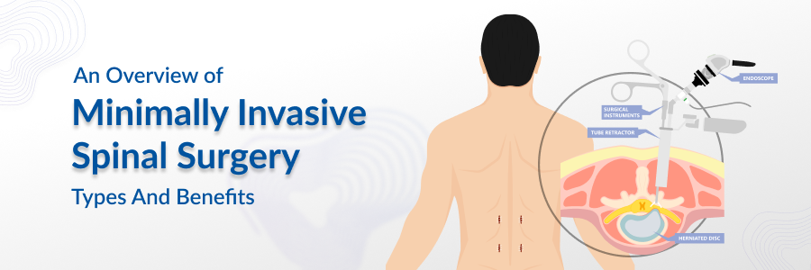 minimally invasive spinal surgery types benefits