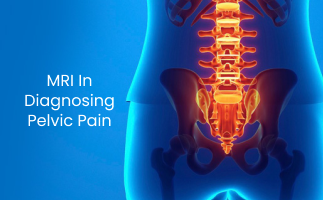 The Role of MRI in Diagnosing Pelvic Pain