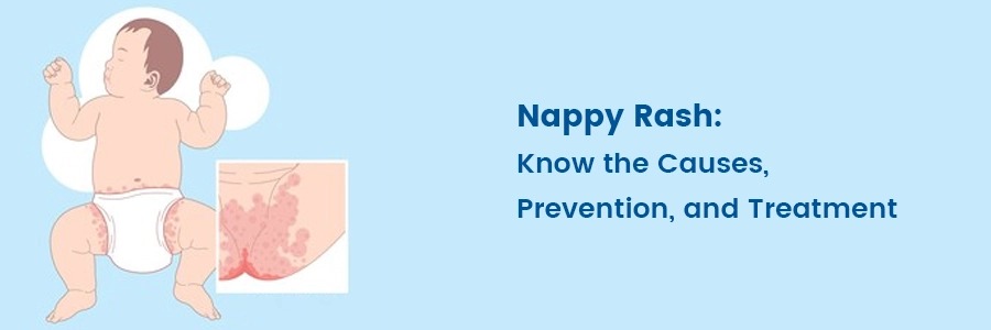 Nappy Rash | Medicover