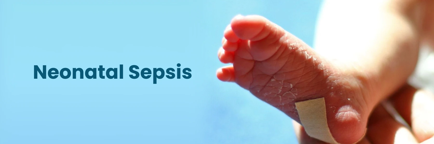 Neonatal Sepsis