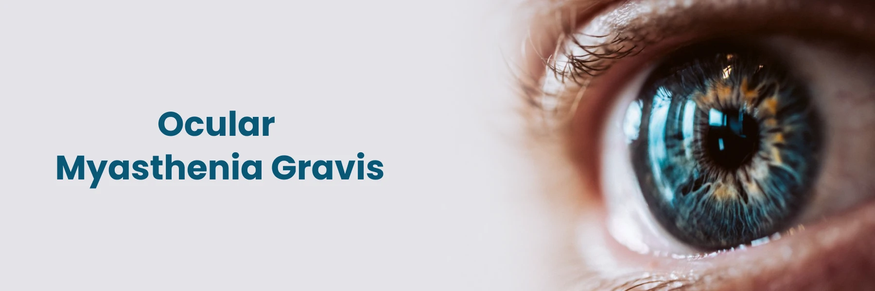 Ocular Myasthenia Gravis