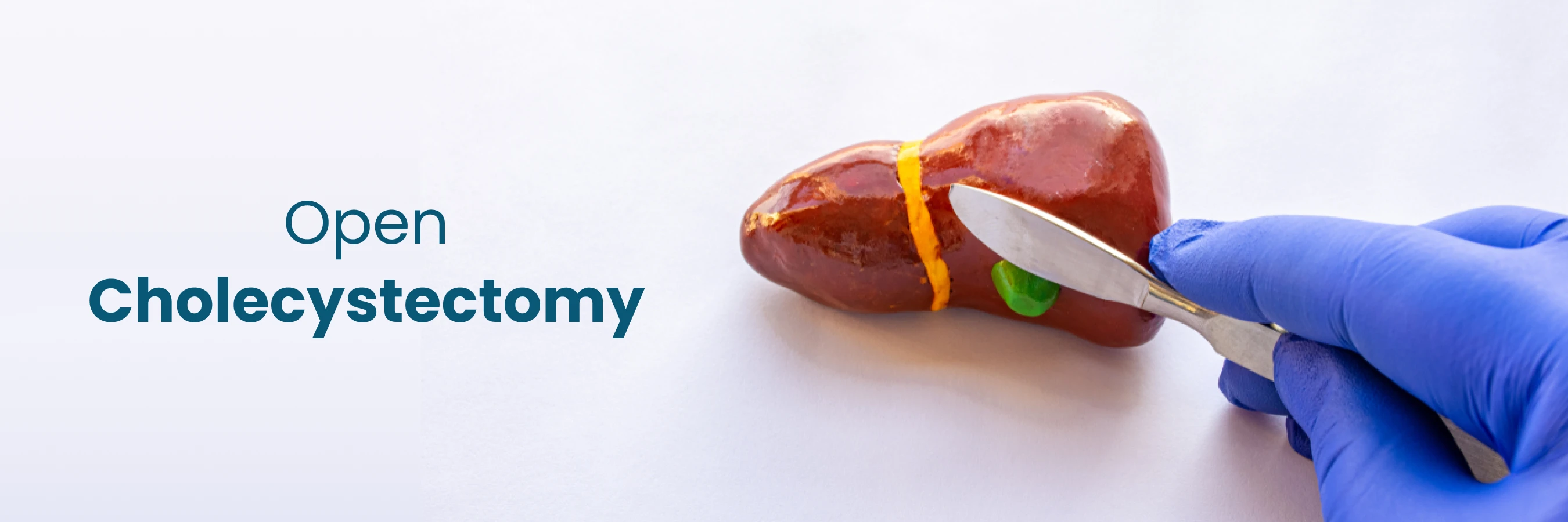 Open Cholecystectomy