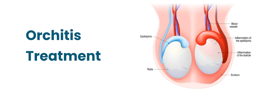 Orchitis Treatment