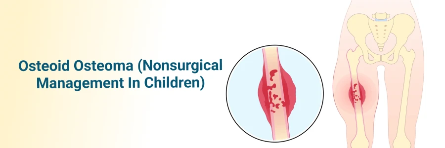 Osteoid Osteoma (Nonsurgical Management In Children)